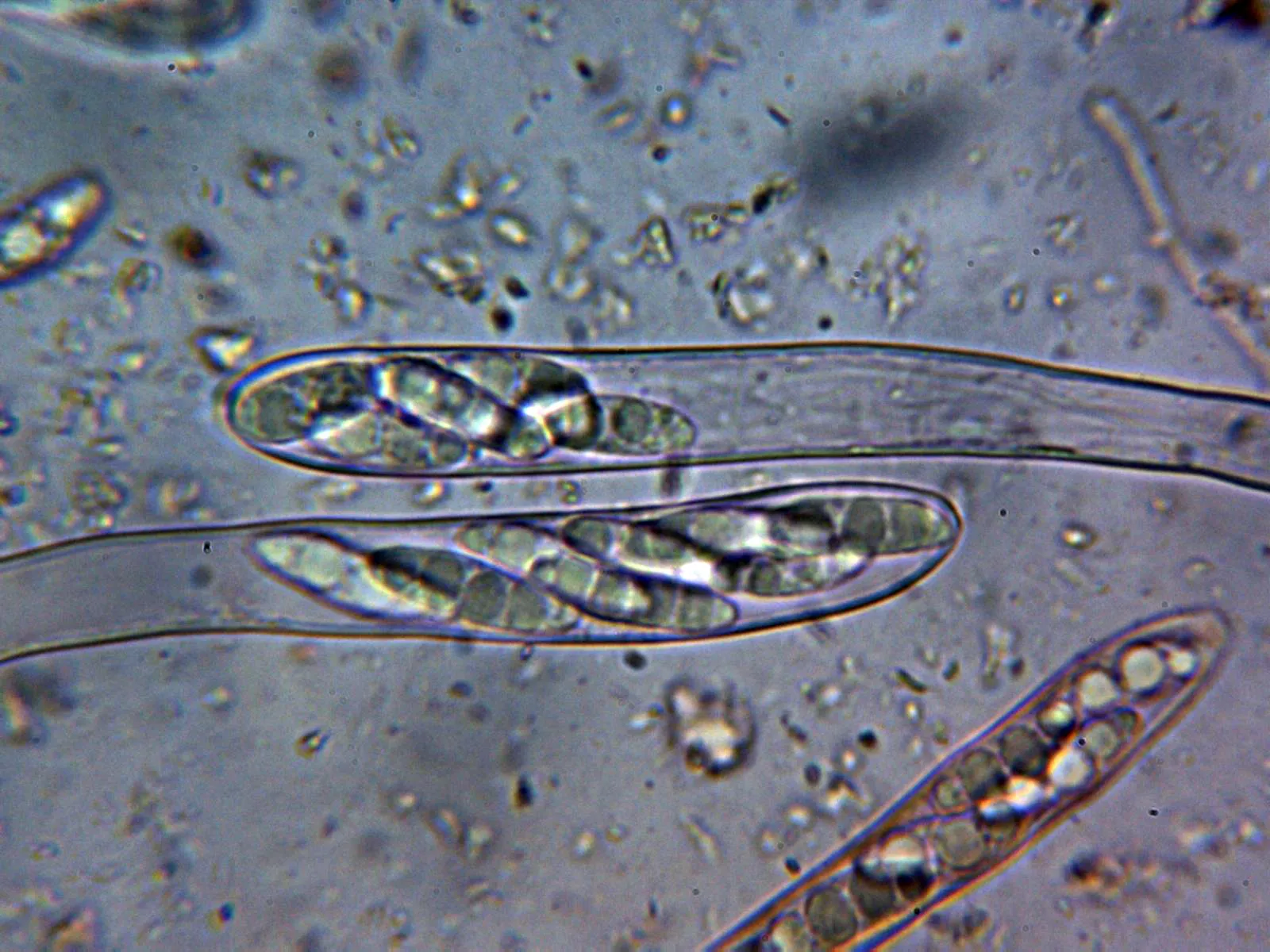 Microscopía de Microglossum griseoviride - 10 - Ascos 1